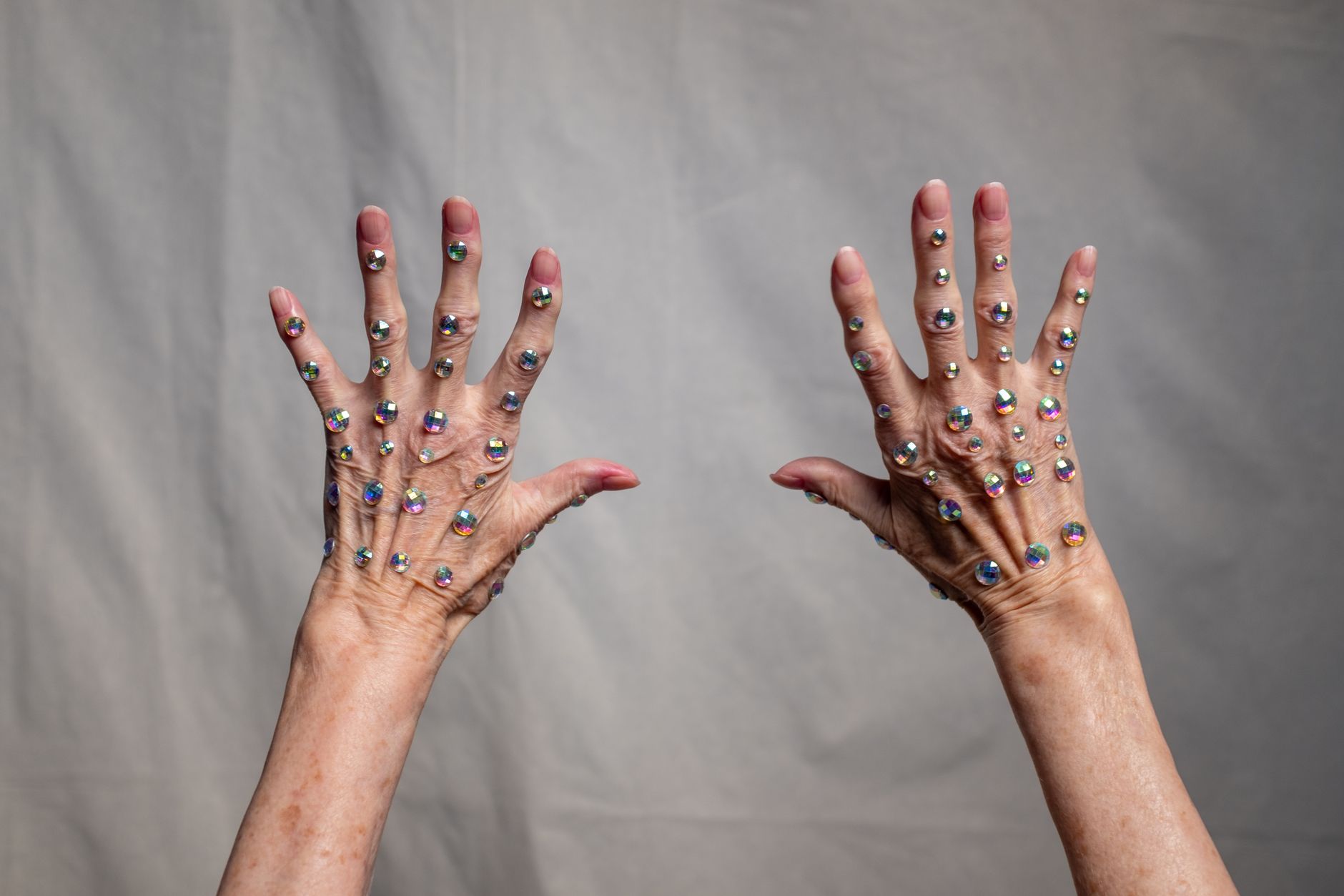 Rheumatoid Arthritis: Beyond Swollen Joints - Uncovering Hidden Symptoms