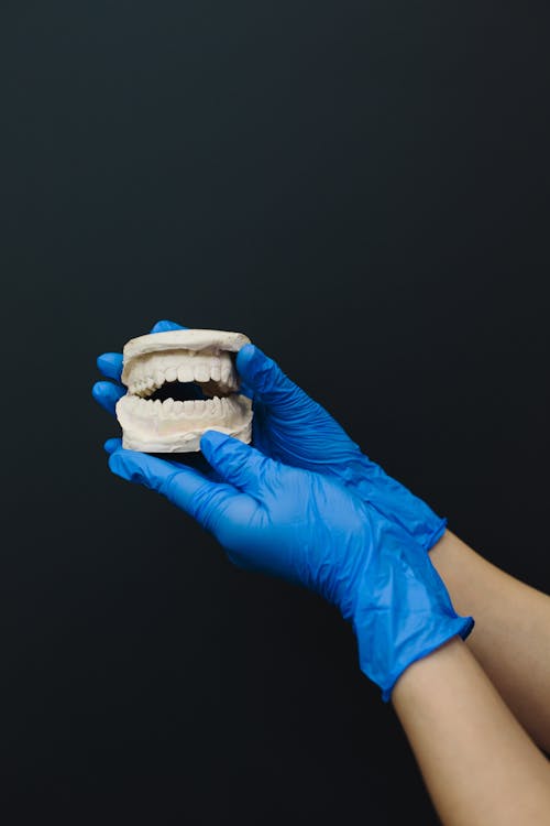Free Person with Latex Gloves Holding a Dental Cast Stock Photo
