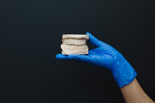 Free Person Wearing Blue Latex Gloves Holding a Dental Cast Stock Photo