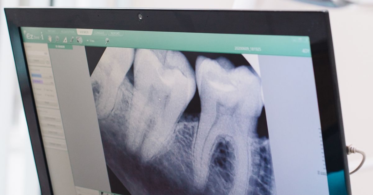 Tooth Screen Black Flat Screen Monitor Turned on Displaying Person's Teeth · Free ...
