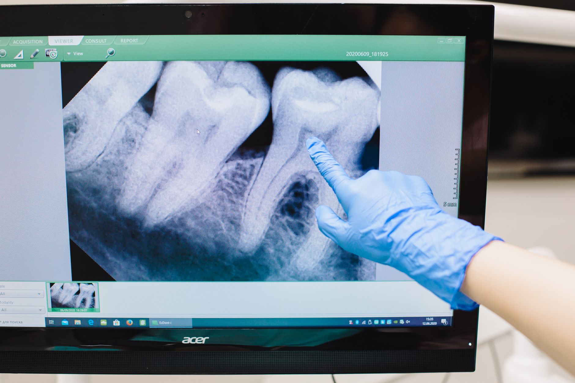 Digital Radiography - Denwest Dental Clinic Digital Radiography in Richmond Hill, Ontario - Why Digital Radiography is Essential for Richmond Hill Dental Health?