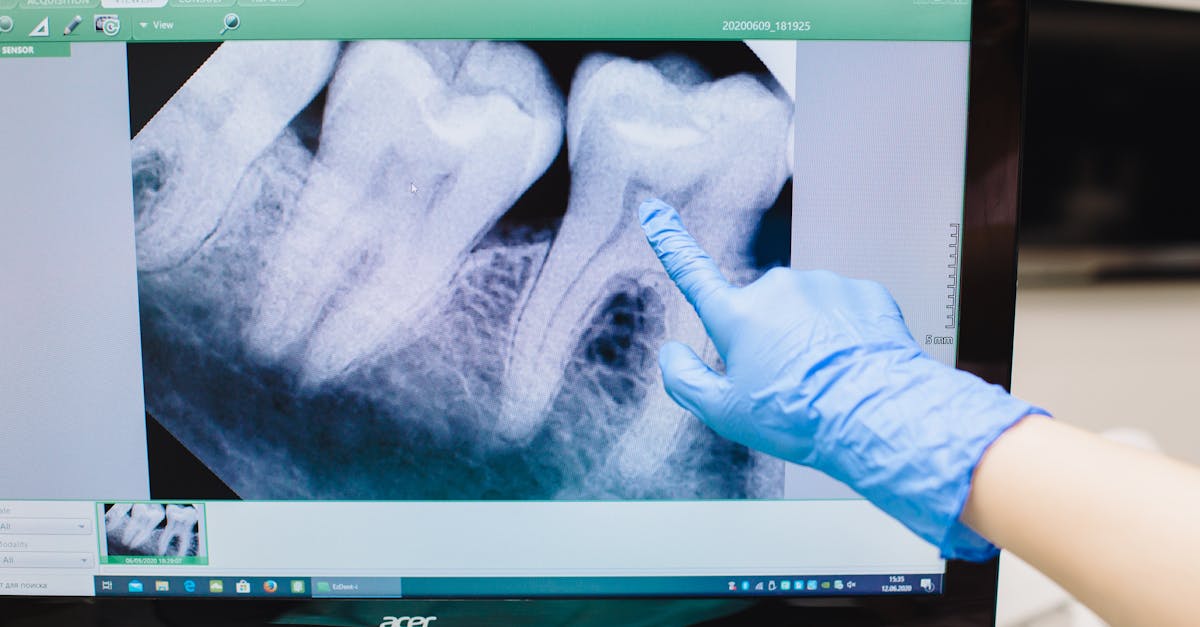 건강검진 중요성 이미지 - 상세 이미지 1