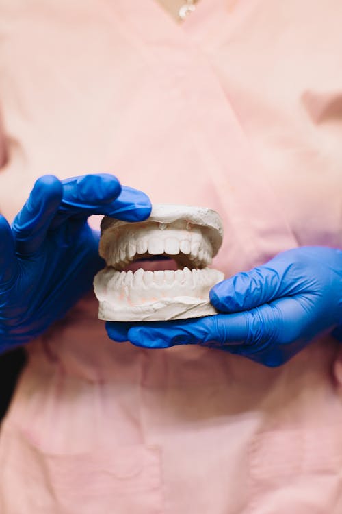 Person with Blue Latex Gloves Holding a Dental Cast