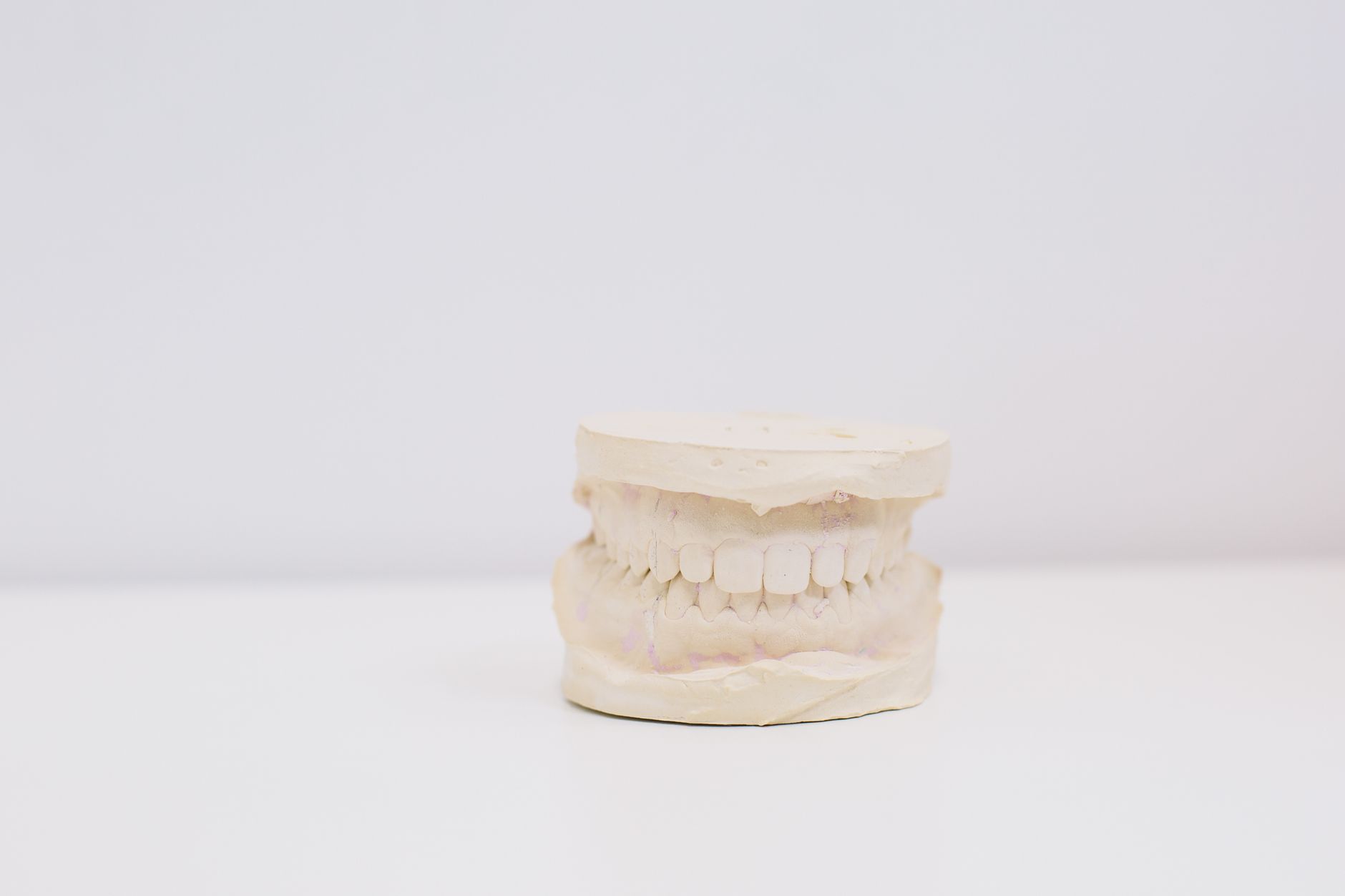 Goteira oclusal transparente sobre modelo de dentes