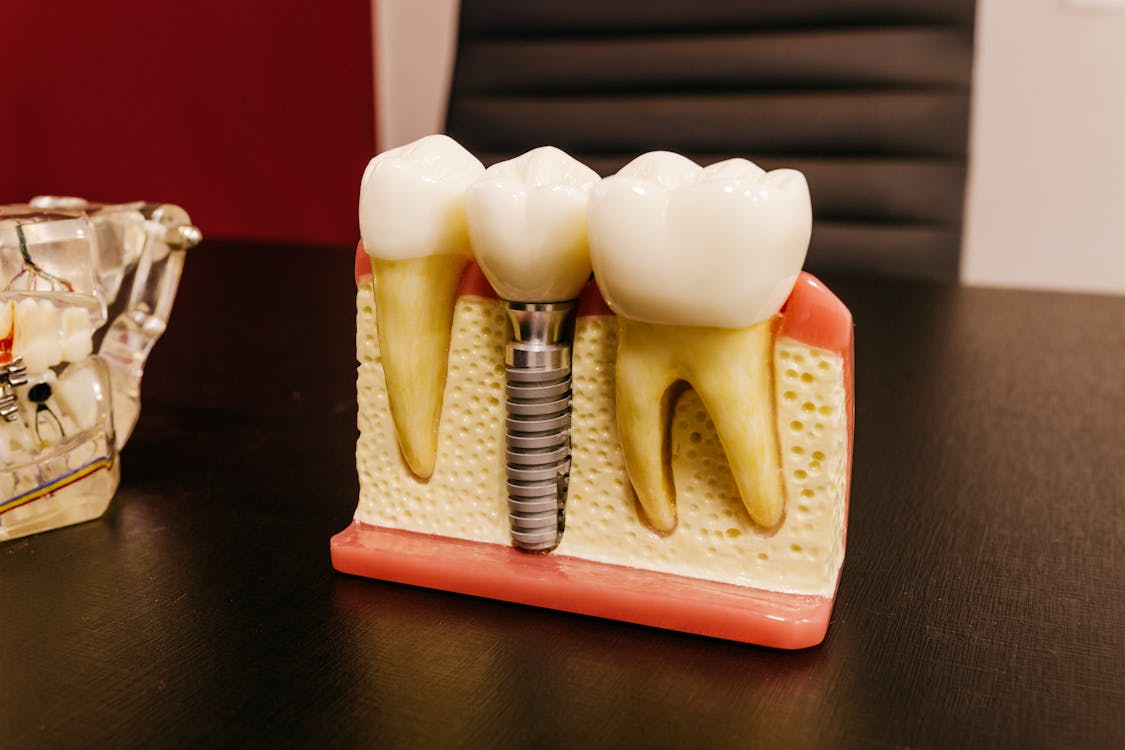 Free Dental implants with screw on table in clinic Stock Photo