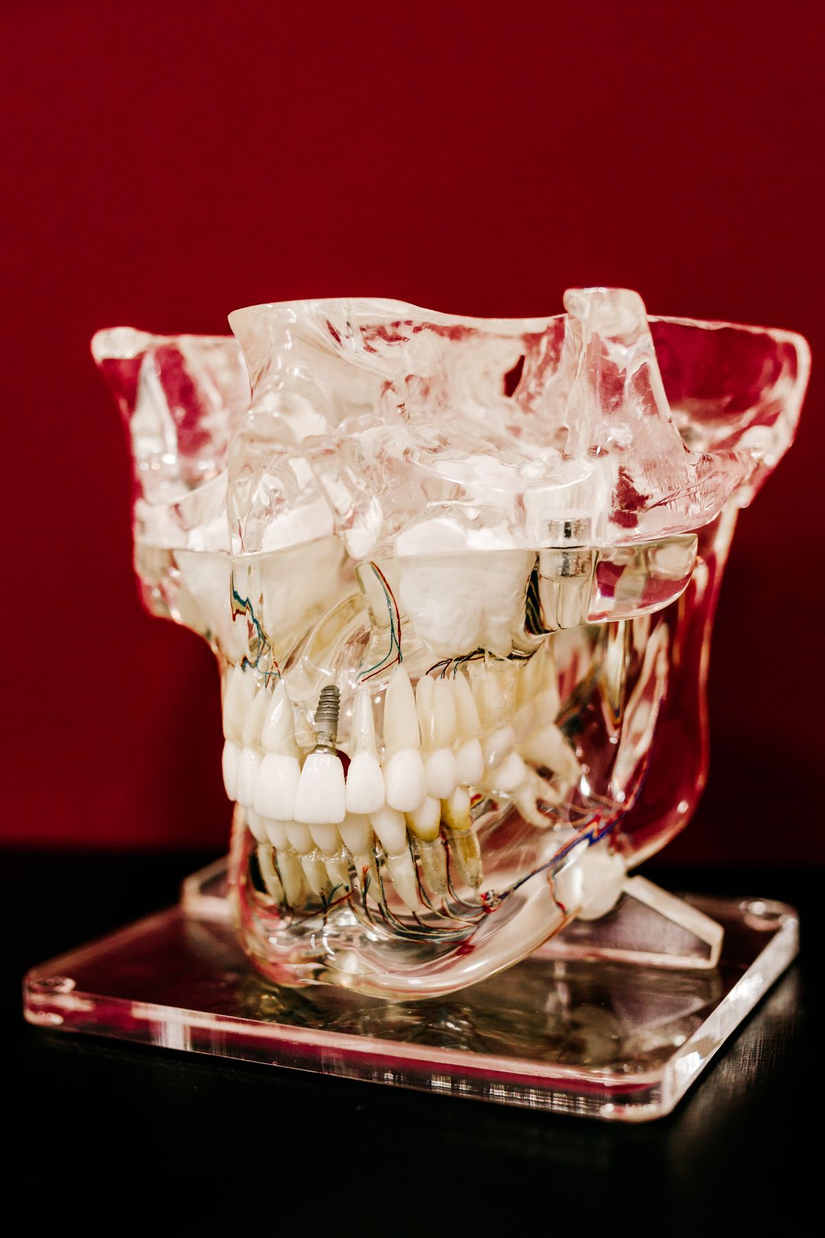Jaw and tooth-root model used to explain root canal anatomy