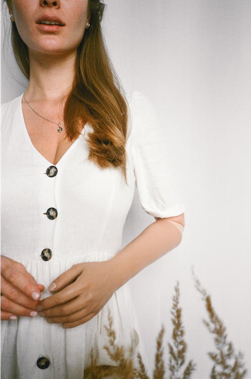 Woman in White Dress with Prosthetic Arm