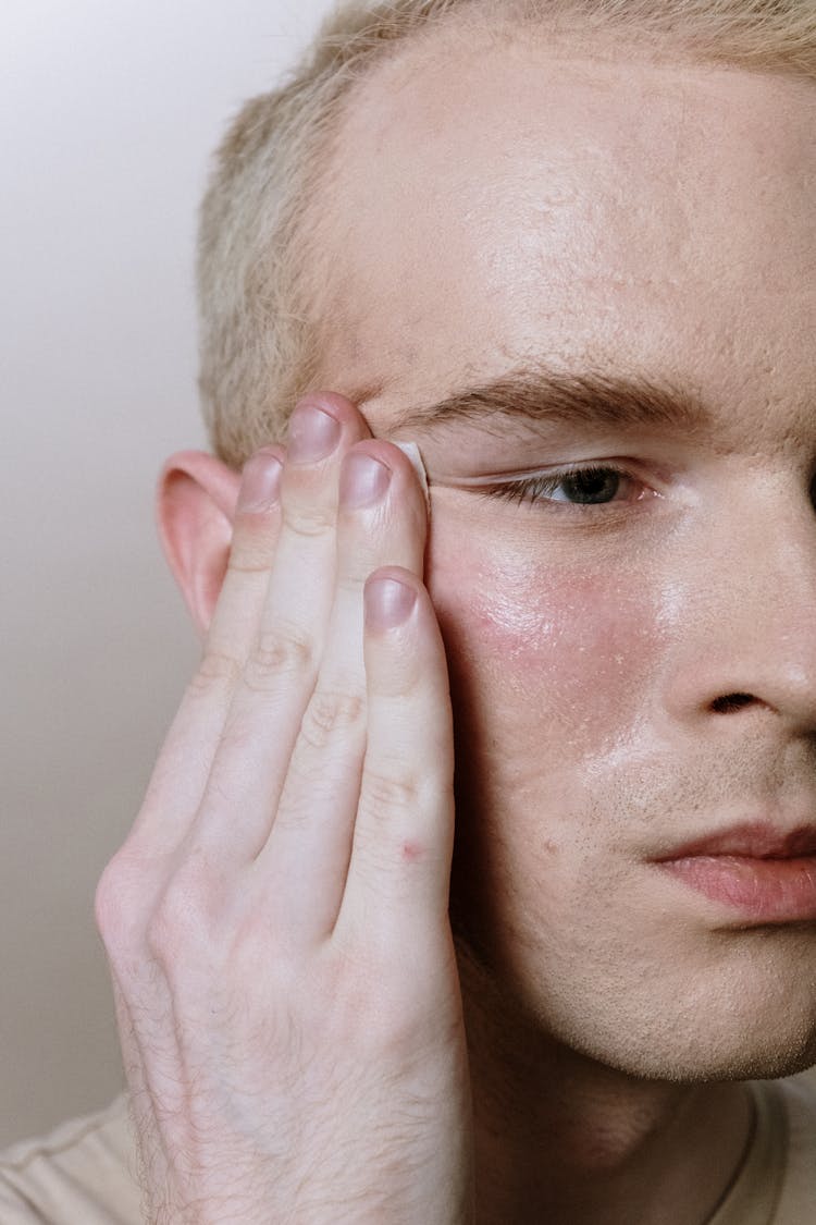 Man With White Hair Covering His Face