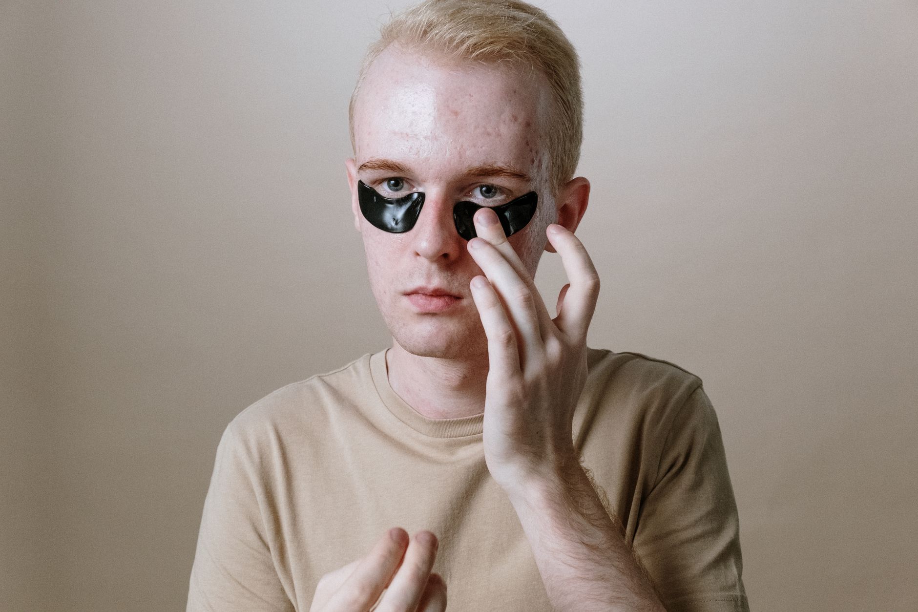 Understanding Dry Eye Inflammation: Causes, Symptoms, and Management