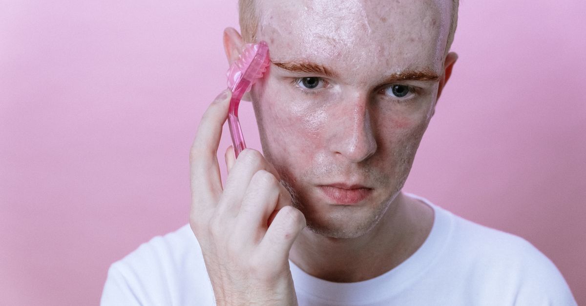 How Do Retinoids Treat Acne