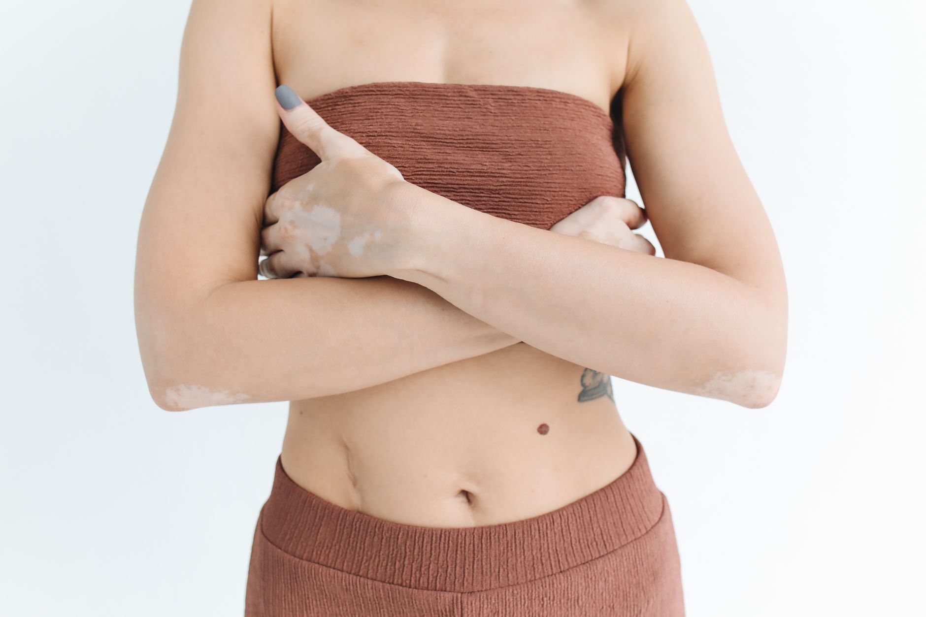 Is Eczema Genetic? Understanding the Link and What It Means for You