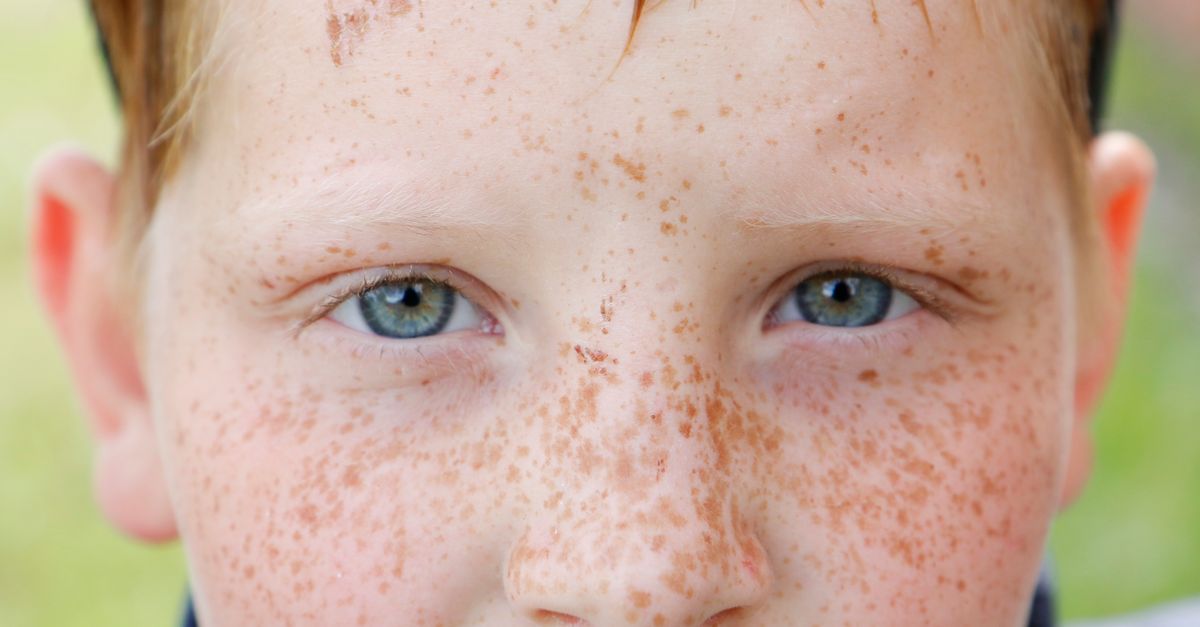 CDC Director Disputes Pennsylvania's Measles Death Reports