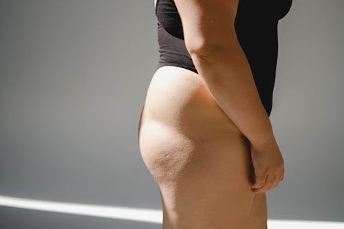 Sunlight and Shadow on Hip of a Woman