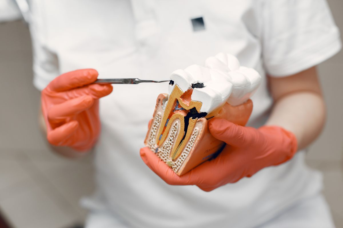 Dentist holding a cross-section tooth model demonstrating root canal treatment
