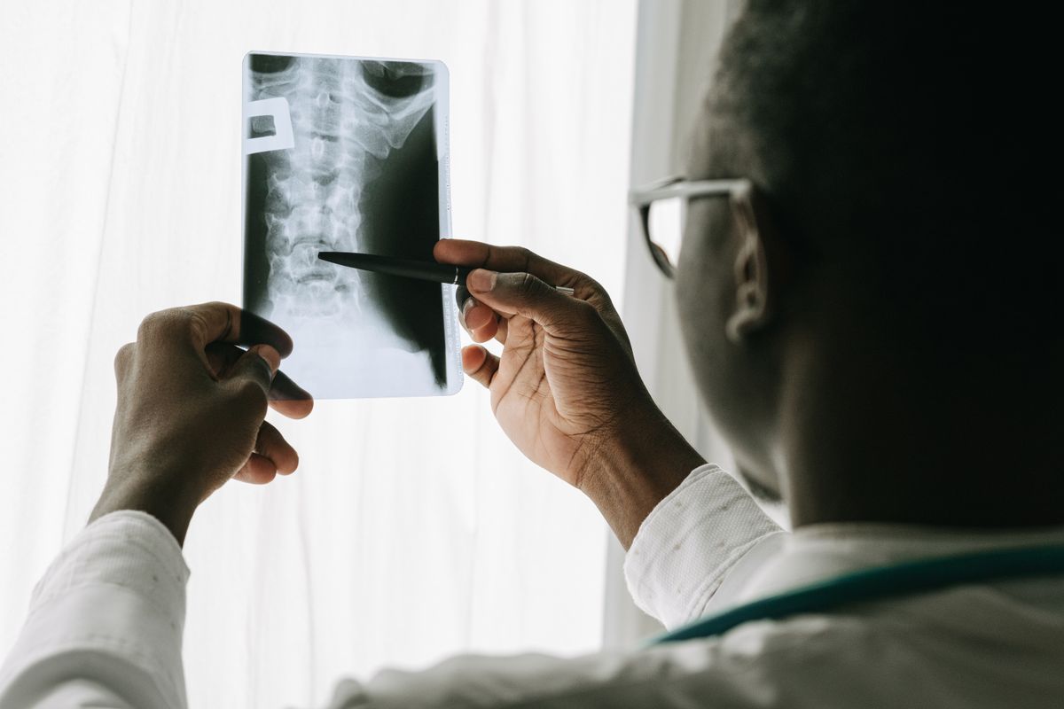 Physician reviewing a spine X-ray