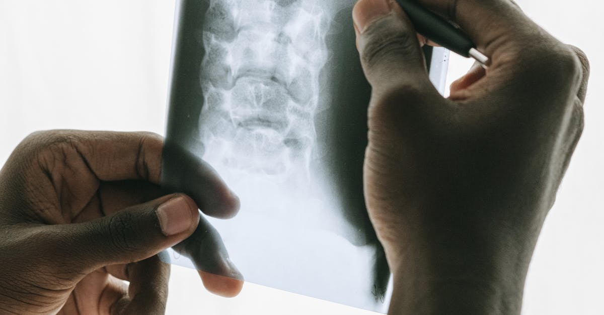 How long do MRI scan results take UK