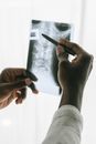 Person Holding Black Pen and an X ray