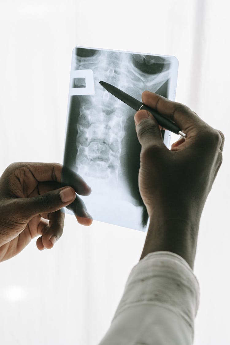 Person Holding Black Pen And An X Ray