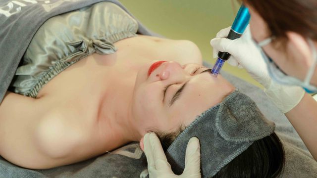 Peeling Elétrico em Campinas: Guia Completo de Cuidados Pós-Procedimento para Resultados Impecáveis - Augusta Perfection