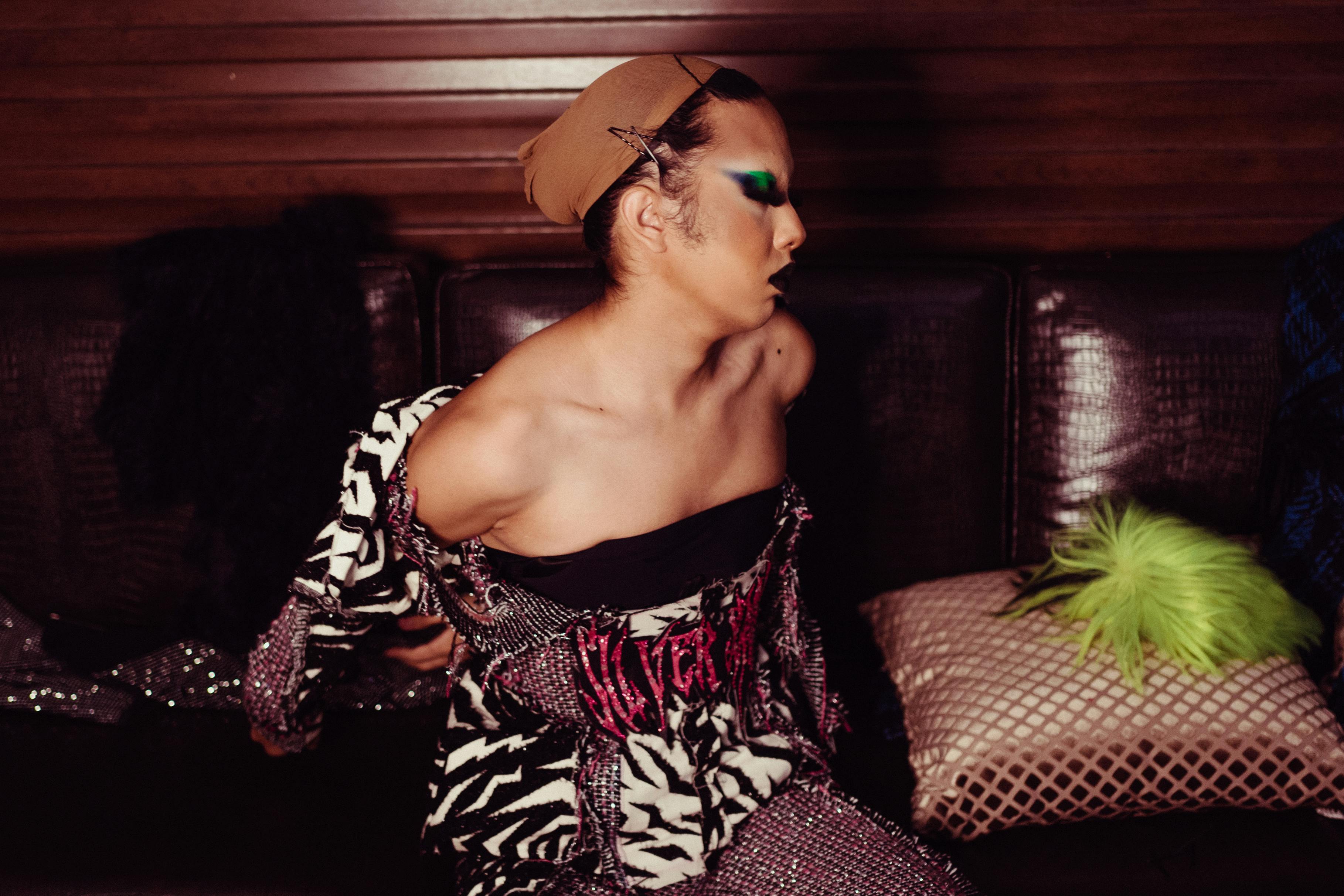 What happens to a man after his prostate is removed?