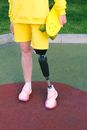 Person with Prosthetic Leg Holding Skateboard