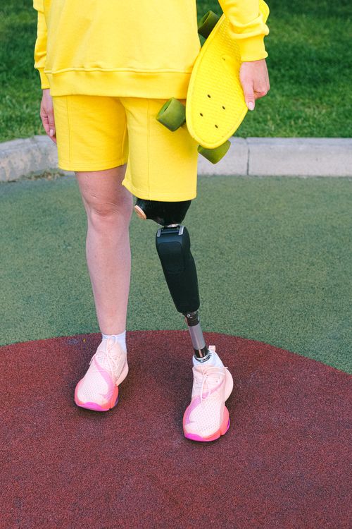 Free Person with prosthetic leg standing outdoors, holding a skateboard, symbolizing determination. Stock Photo