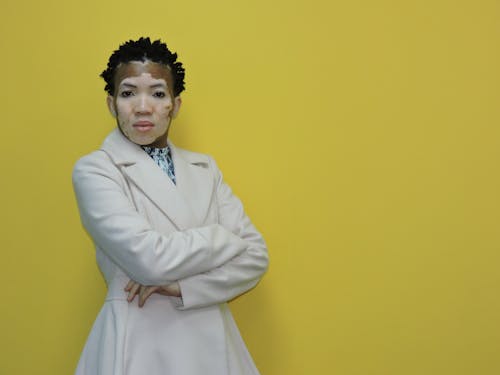 Бесплатное стоковое фото с афро-американка, белое пальто, витилиго