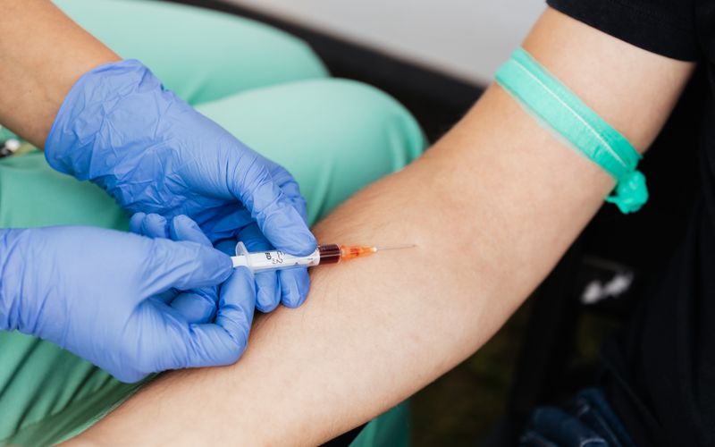 PRP kan alımı, klinik — Eskişehir