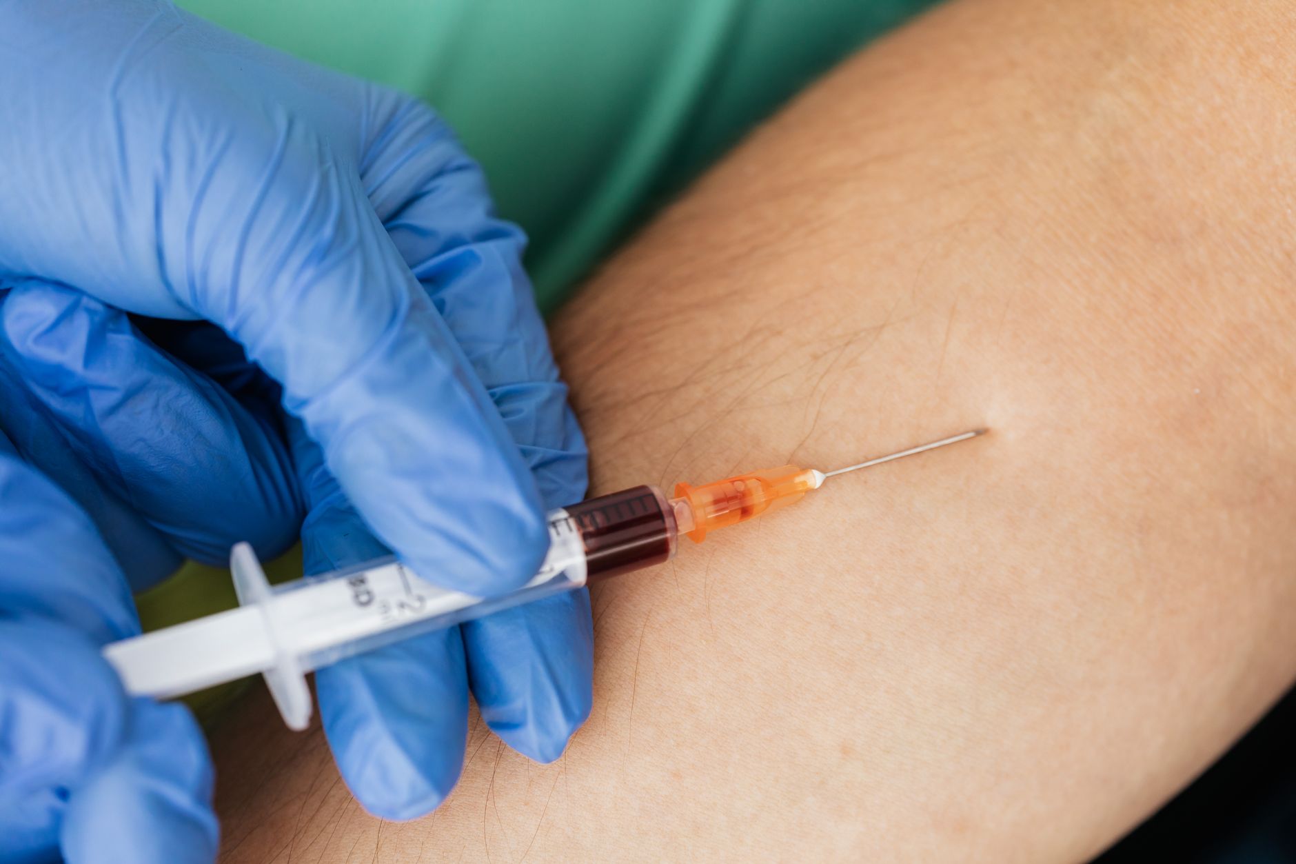 Understanding Aplastic Anemia: What a CBC Test Reveals