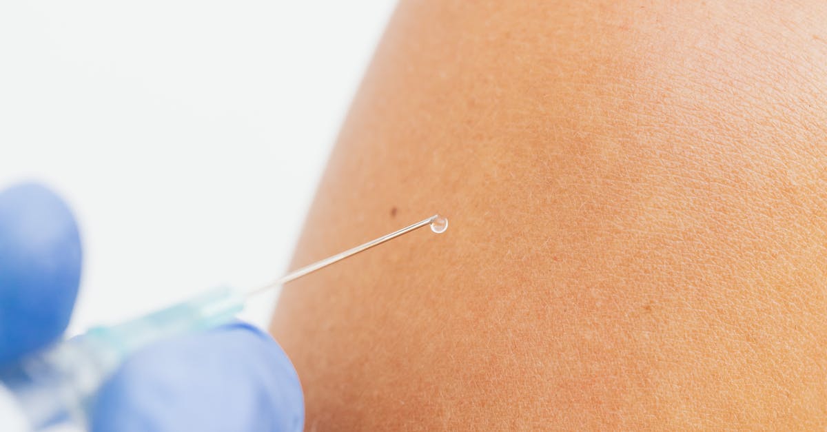 How to treat chafed skin overnight