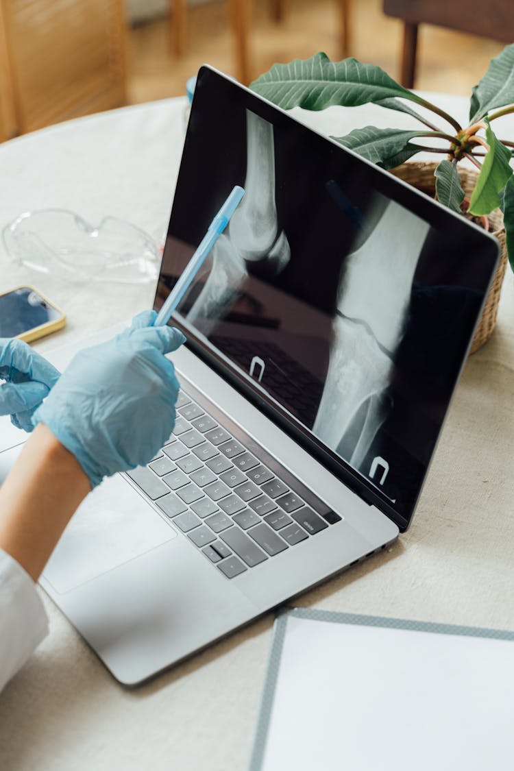 Doctor Looking At The Bones On A Laptop Screen