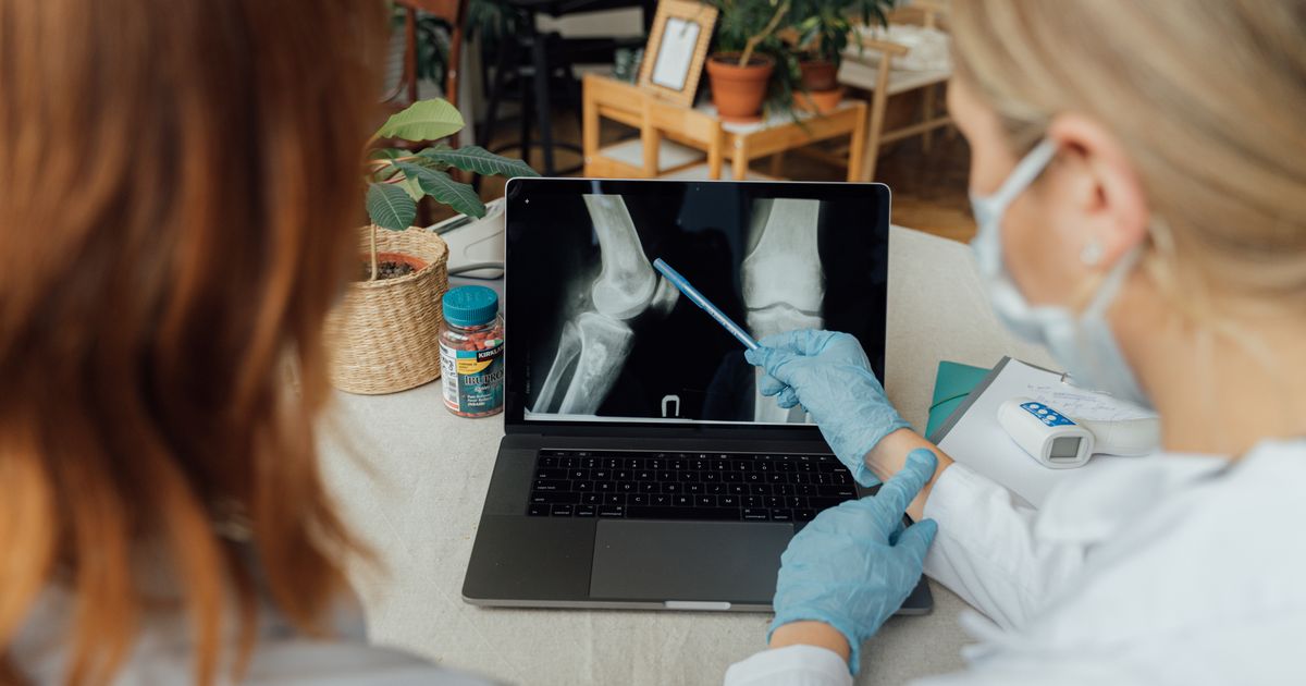 Doctors reviewing joint imaging on a laptop