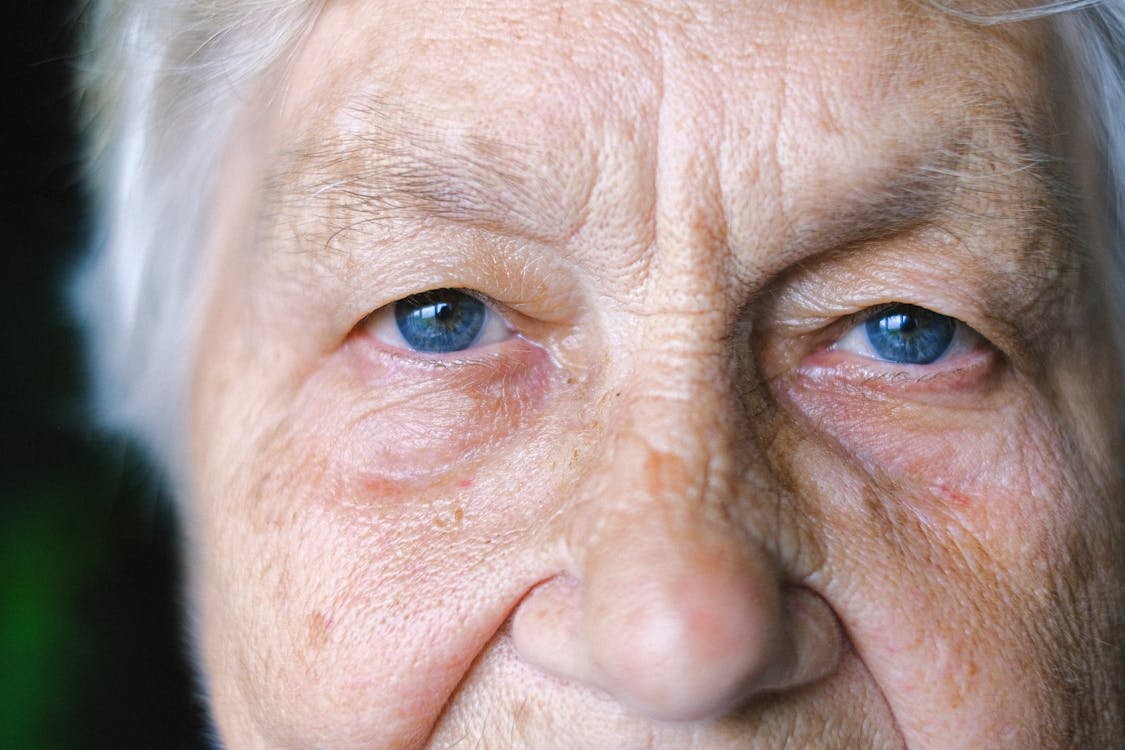  Closeup of an elderly woman's eyes