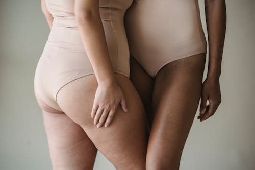 Gratis Immagine gratuita di diversità del corpo, donne, gambe Foto a disposizione