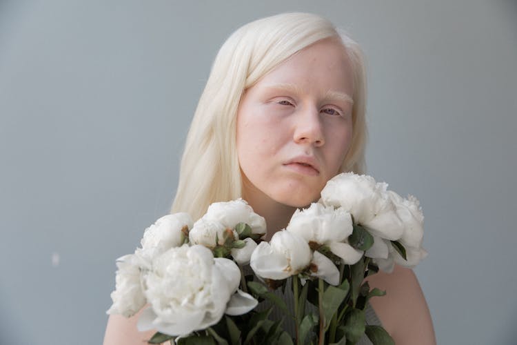 Calm Albino Woman With Roses