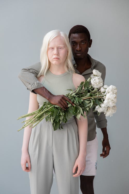 Black man standing behind back of albino woman