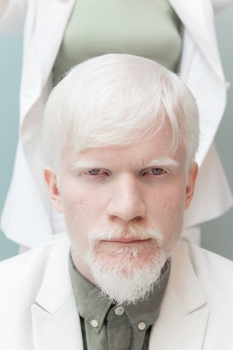 Serious Albino Man In Modern Studio