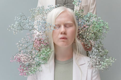 Young Albino woman in gentle flowers