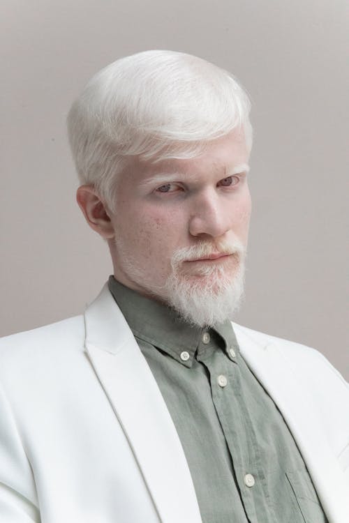 Confident albino man in trendy suit