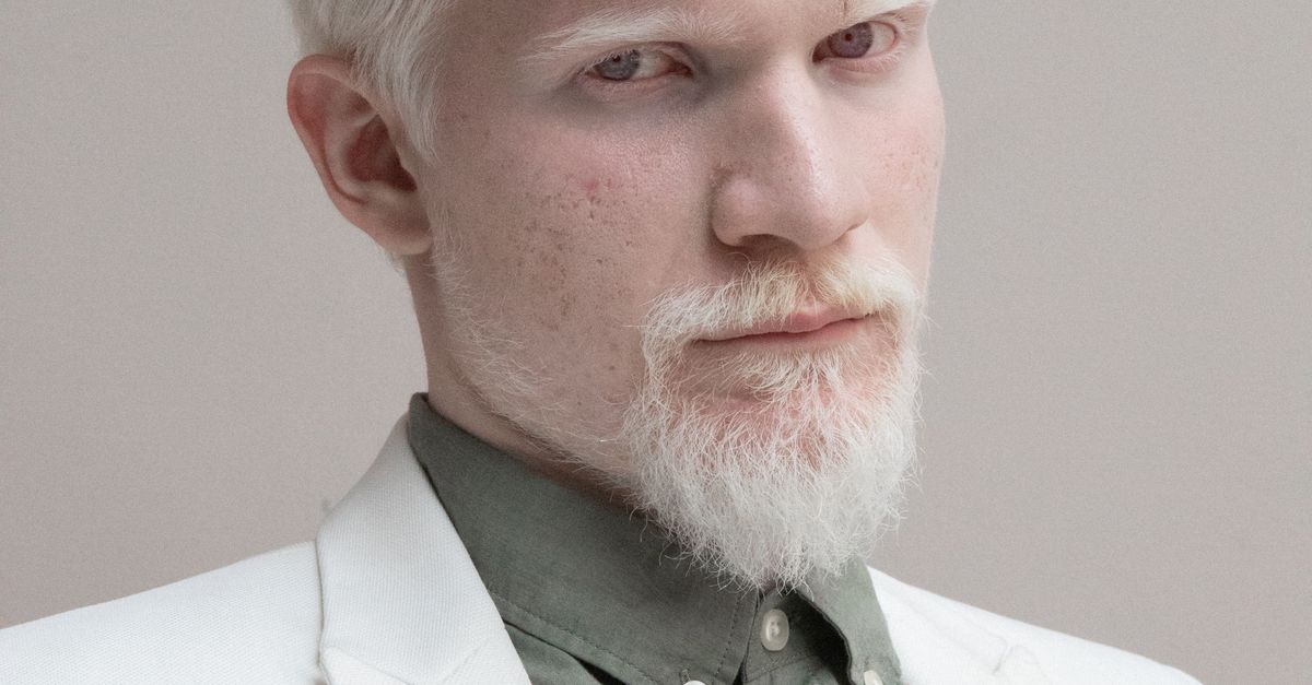 Confident albino man in trendy suit