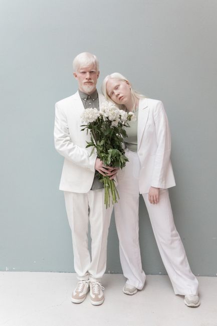 Full length of stylish albino couple in elegant suits standing close and holding bouquet of flowers while looking at camera