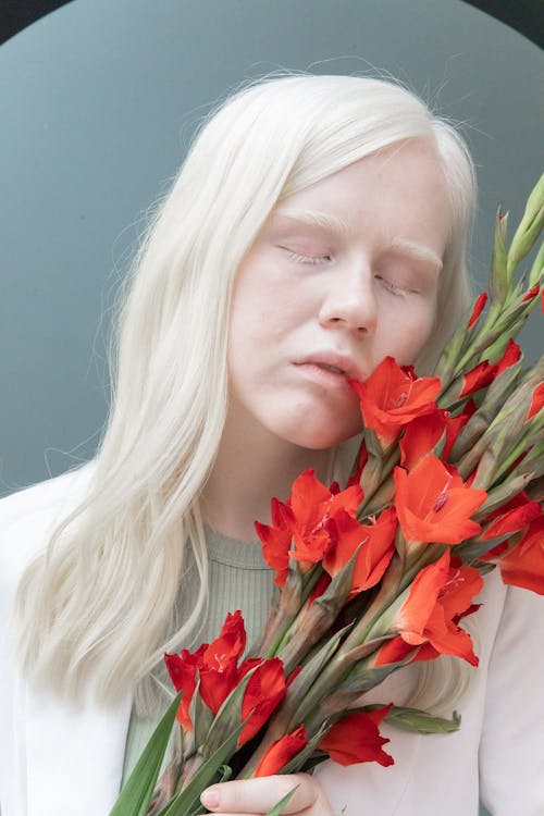 Mujer Albina Con Ramo De Flores Rojas