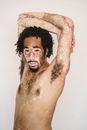 Young ethnic male with white spot disease and arms on head looking at camera on white background of studio