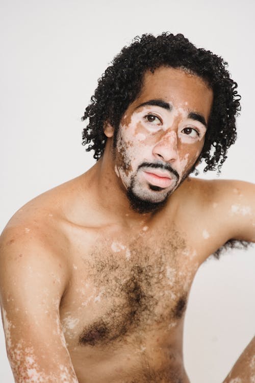無料 スタジオで白斑肌を持つ上半身裸の黒人男性 写真素材