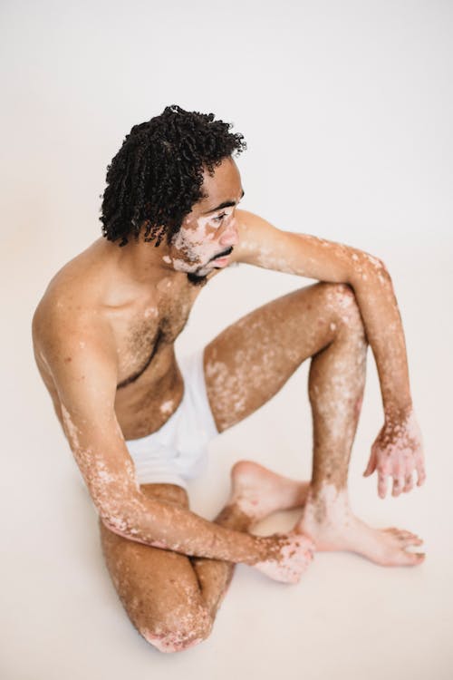 Calm black man with vitiligo sitting on white floor