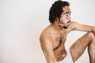 Young pensive unshaven African American male in underwear with vitiligo skin condition looking away