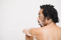 Pondering ethnic man with vitiligo skin condition