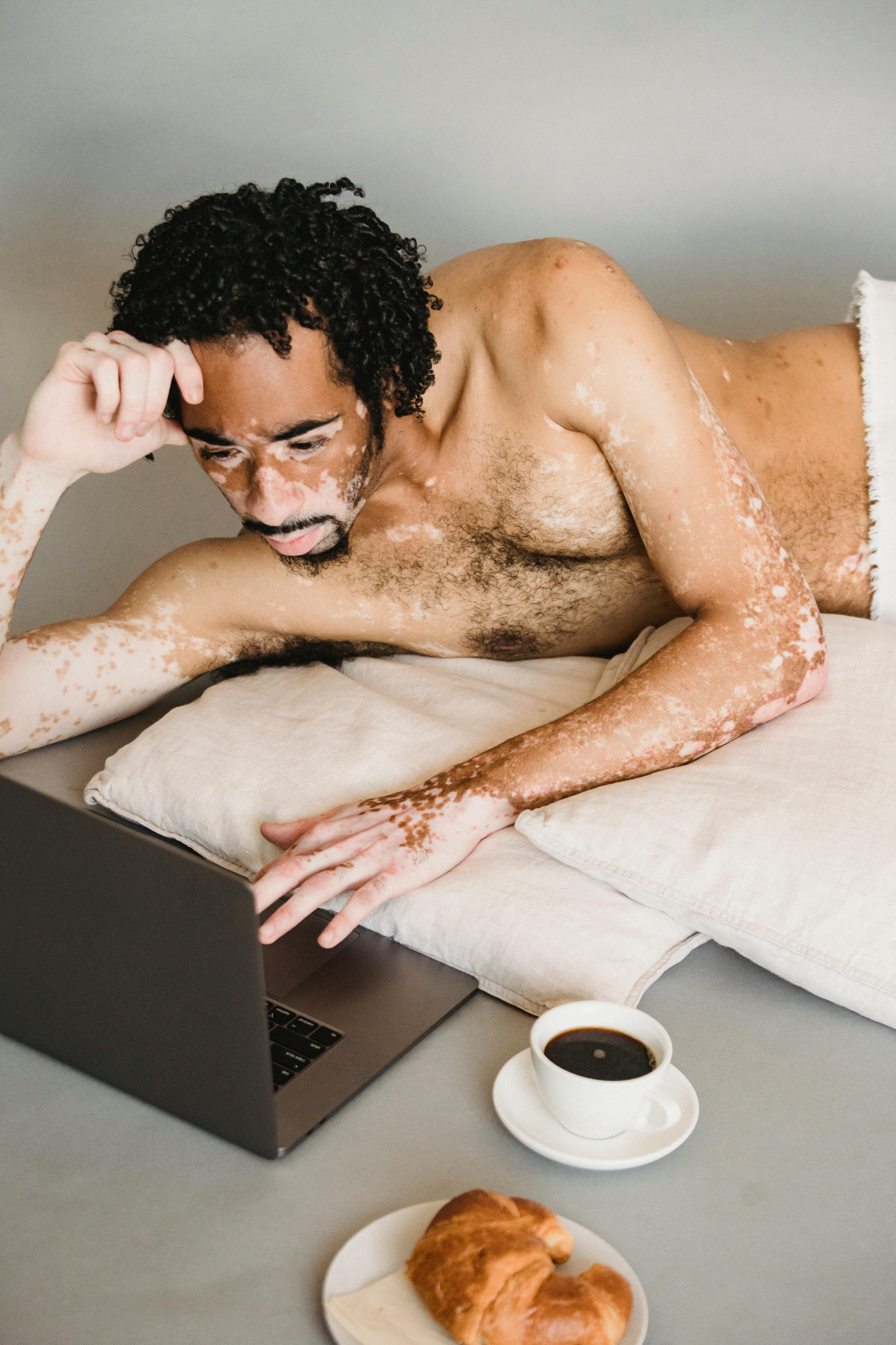 shirtless black man with vitiligo surfing laptop on floor