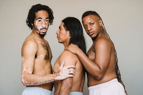 Side view unemotional American Indian man in underpants standing between shirtless African American male with vitiligo and black bisexual male with naked torso and long braids