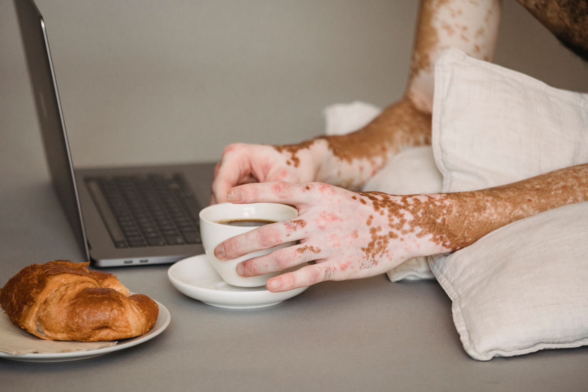 Psoriatic Arthritis and Neurological Complications: What You Need to Know